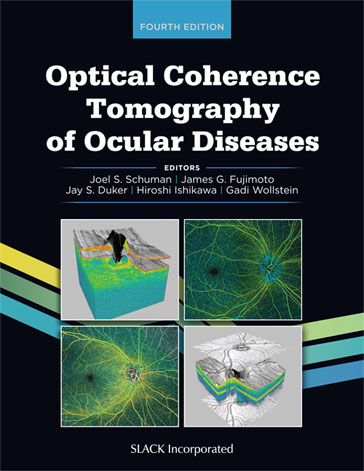 Optical Coherence Tomography of Ocular Diseases, Fourth Edition