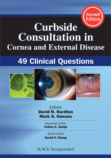 Curbside Consultation in Cornea and External Disease: 49 Clinical Questions, Second Edition